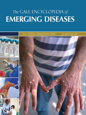 cover image of Gale Encyclopedia of Emerging Diseases